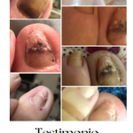 JoyPretty™ el cuidado intensivo de uñas+ envio gratis  L800 (manos y pies)