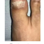 JoyPretty™ el cuidado intensivo de uñas+ envio gratis  L800 (manos y pies)