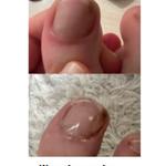 JoyPretty™ el cuidado intensivo de uñas+ envio gratis  L800 (manos y pies)