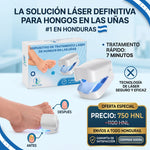 PodoLaser ™ - Dispositivo de Fototerapia para Uñas con Hongos