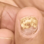 JoyPretty™ el cuidado intensivo de uñas+ envio gratis  L800 (manos y pies)