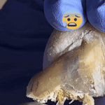 JoyPretty™ el cuidado intensivo de uñas+ envio gratis  L800 (manos y pies)